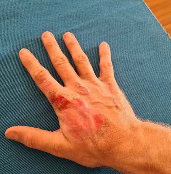 Image placeholder title